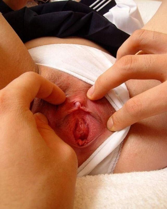 Free porn pics of doctor spreading labia minora 21 of 25 pics