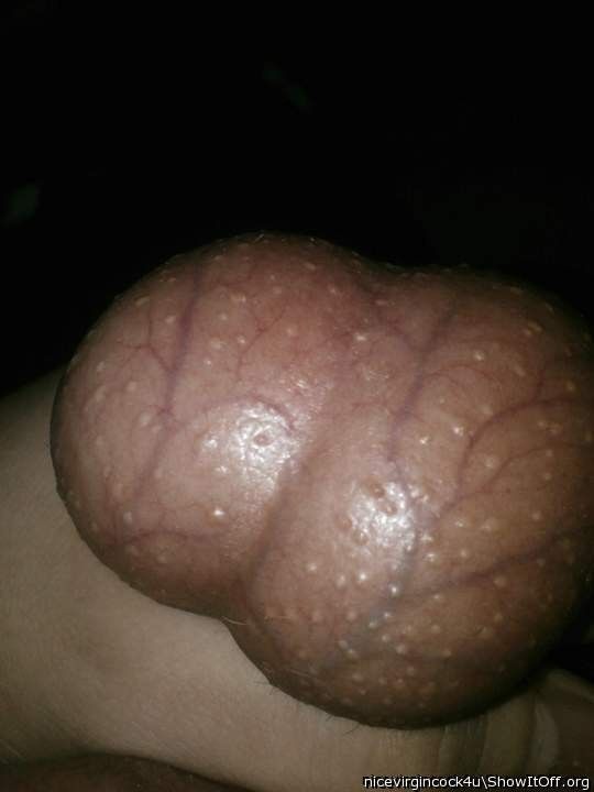 Free porn pics of Bulging balls 5 of 11 pics